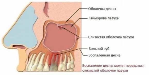 ��� ������������� ������ �� ��������: ����� ������������� ��������